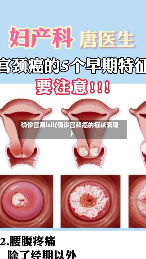 确诊宫颈lsll(确诊宫颈癌的症状表现)