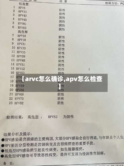 【arvc怎么确诊,apv怎么检查】