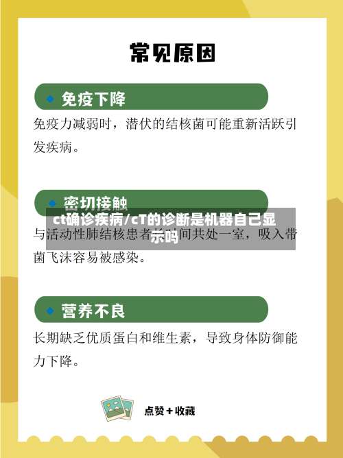 ct确诊疾病/cT的诊断是机器自己显示吗