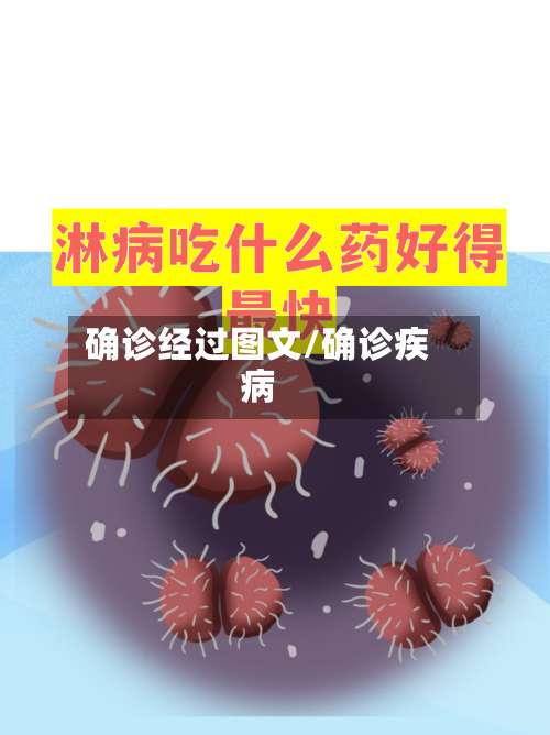 确诊经过图文/确诊疾病