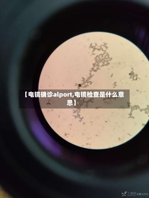 【电镜确诊alport,电镜检查是什么意思】