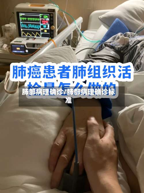 肺部病理确诊/肺部病理确诊标准-第2张图片