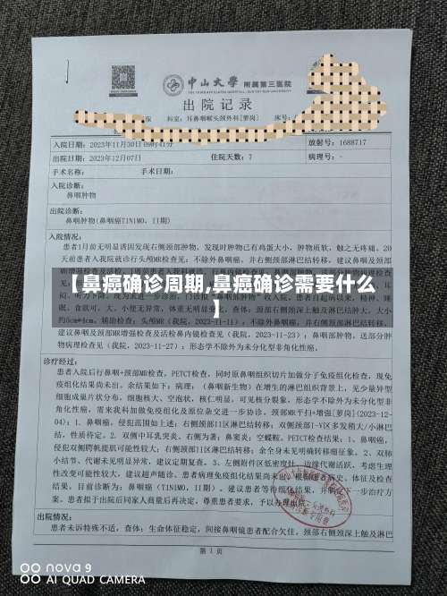 【鼻癌确诊周期,鼻癌确诊需要什么】